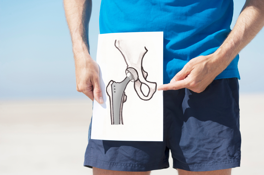 Как можно понять, что пришло время для эндопротезирования сустава